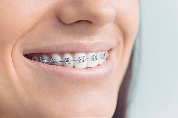 Best Dental Inlays and Onlays  in Cavalero, WA